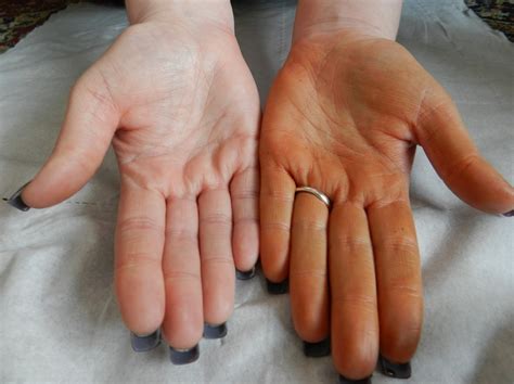 orange hands spray tan.